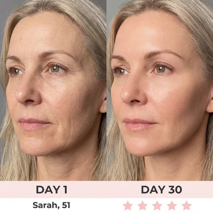 Eleanora™ Face Lifter