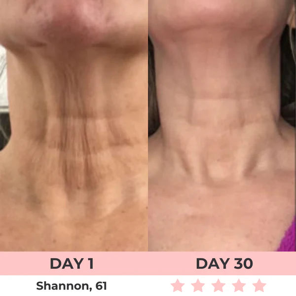 Eleanora™ Face Lifter