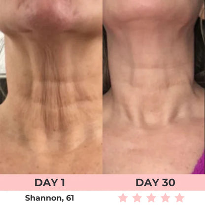 Eleanora™ Face Lifter