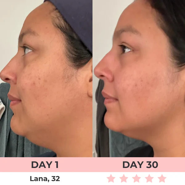 Eleanora™ Face Lifter