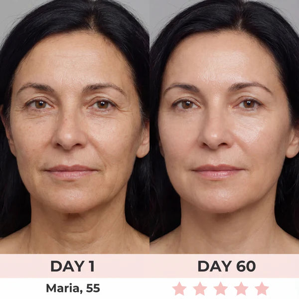 Eleanora™ Face Lifter