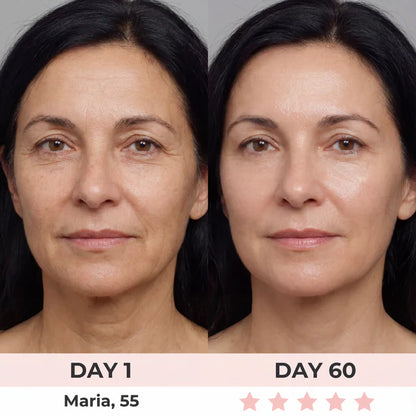 Eleanora™ Face Lifter